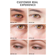 ARTISCARE Golden Repair Eye Cream Eye Bags from Wrinkles Cream for Eyes Lifting Anti Aging Dark Circles Whitening Moisturizing