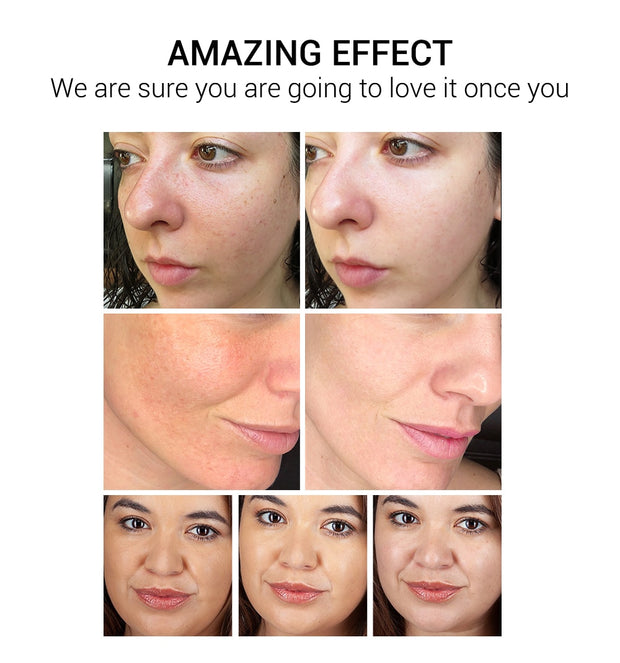 Facial Cream Repair Fade Freckles Remove Dark Spots
